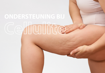 Wat te doen tegen Cellulite? Oplossingen en Behandelingen voor Sinaasappelhuid